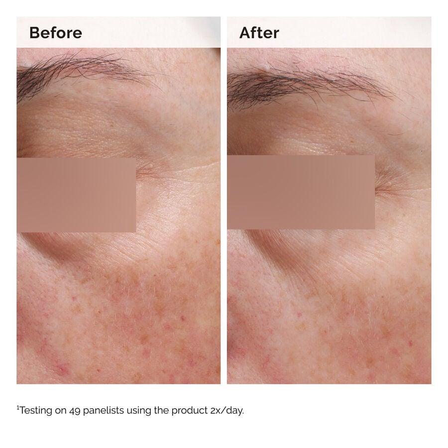 niacinamide-5-face-and-body-emulsion-c7 2024-08-23-ORD-Nia-5pct-Face-Body-B-A-Elasticity-Global-02-1x1.jpg
