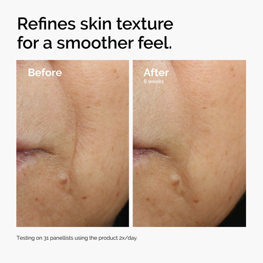 caffeine-3-escin-1-face-serum-j6 ord-caffeine-3pct-escin-1pct-face-serum-before-after-texture.jpg