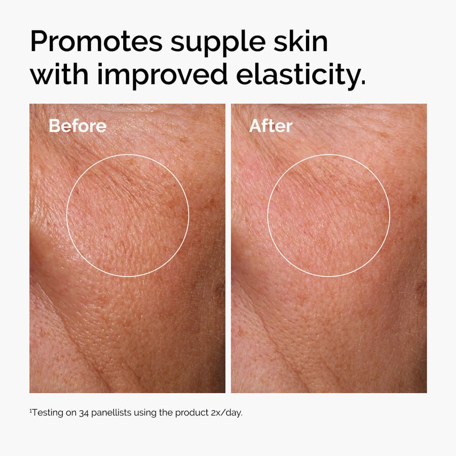 hyaluronic-acid-2-b5-with-ceramides-u8 ord-hyaluronic-acid-2pct-b5-hydrating-serum-before-after-elasticity.jpg