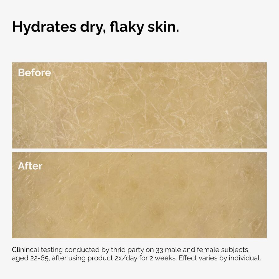 the-body-care-collection-i5 ord-natural-moisturizing-factors-inulin-body-before-after-graphic-02.jpg