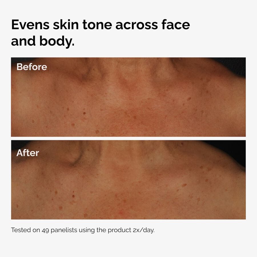the-body-care-collection-i5 ord-niacinamide-face-body-serum-before-after-even-tone-graphic.jpg