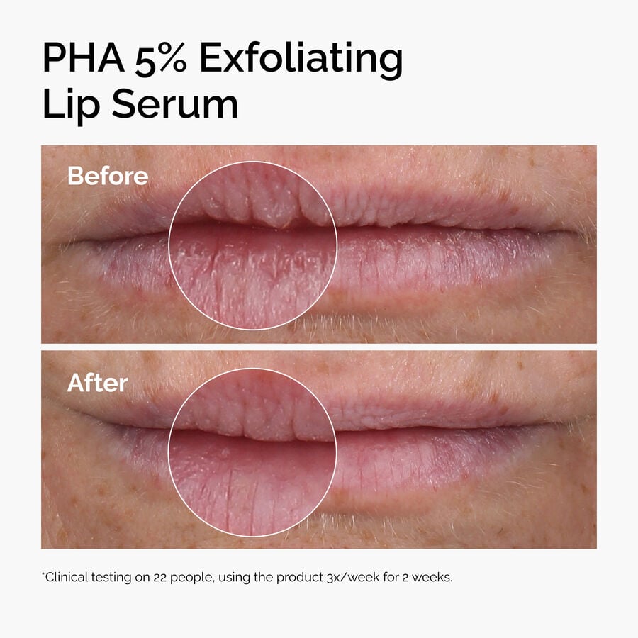 pha-5-exfoliating-lip-serum-n3 ord-pha-5pct-lip-exfoliating-serum-before-after.jpg