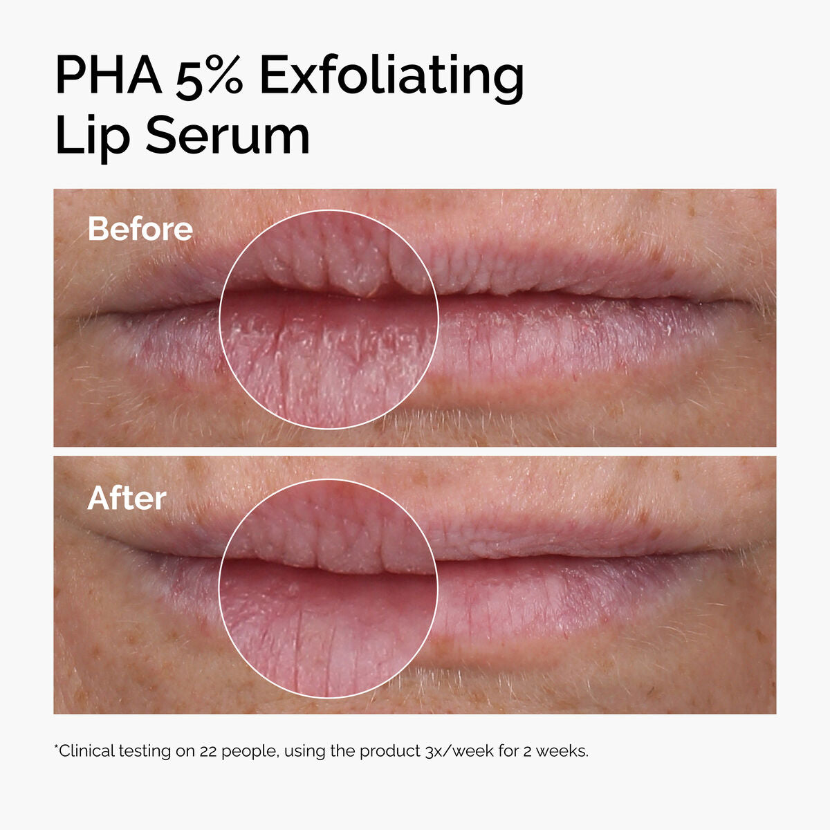 pha-5-exfoliating-lip-serum-n3 ord-pha-5pct-lip-exfoliating-serum-before-after.jpg